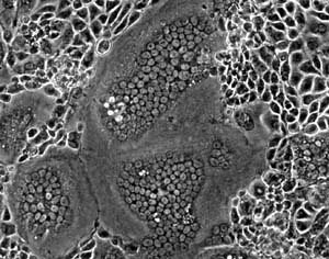 Cells that line the airway and lungs reveal signs of developing human MPV when examined in a petri dish.