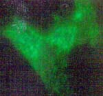 A fluroescent-tagged antibody bearing silver and gold particles reveals I and L bradykinin receptors lit in a ghostly green glow on the surfact of cultured human cells