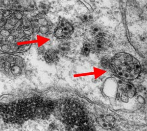 Neurons that have been infected with West Nile Virus.