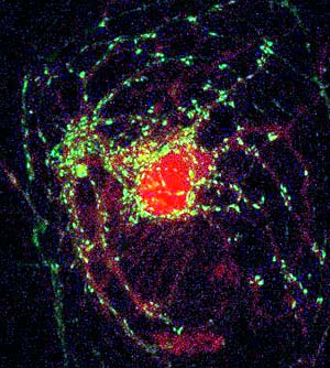 In this micrograph of a neuron, green dye highlights proteins in the tiny spheres that release glutamate, an important chemical messenger linked to nerve cell damage and death during stroke.