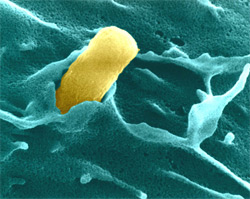 E. Coli sticks to host cell