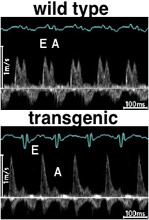 Transgenic mice have an abnormal filling phase of the cardiac cycle.