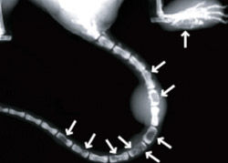 Mice with Tax-induced leukemia/lymphoma develop large tumors and many areas of bone destruction, as shown in this X-ray.