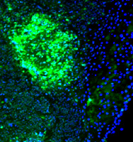 A Peyer's patch, a structure in the small intestine that helps detect and defend against invaders, produces histamine (labeled with an antibody that glows green in this image) in response to infection by the bacterium Yersinia enterocolitica.