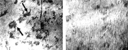 Among other findings, researchers showed that cortisone inhibits resorption of bone, a dismantling process necessary to renew bone and maintain its strength. In the images above, dark areas (marked with arrows) show bone being resorbed. Bone in the image