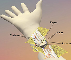 Limb transplantation involves several kinds of tissue.