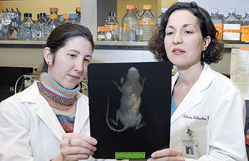 Katherine Weilbaecher, M.D. (right), and Angela Hirbe, an M.D./Ph.D. student, view a film of a mouse with bone metastasis.