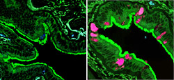 On the left is an image of microscopic airways in normal lung tissue. On the right is lung tissue from a patient with COPD. The pink color highlights cells producing excess mucus, a symptom of COPD.