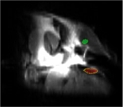 This image combines three MRI scans of a mouse: one is a typical scan showing internal organs, and the second two are scans tuned to the frequency of fluorine-laced nanoparticles (colored red and green).