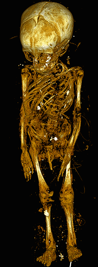 Rendering of the mummy skeleton, which was created by using more than 1,000 slices obtained from high-resolution, whole-body computed tomography (CT) data. Most of the wrappings covering the mummy and soft tissues remaining on the body have been made transparent.