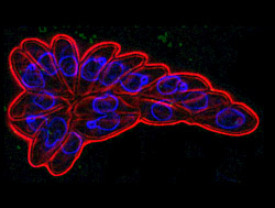 T. gondii parasites inside a cell prepare to burst out of their host. Scientists have found a signal that controls this behavior and blocked it, preventing infection in mice.