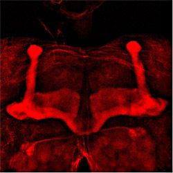 A micrograph shows the mushroom bodies, structures in the fly brain roughly akin to the human hippocampus, which is involved in learning and memory. When researchers genetically tweaked these structures in the brains of fruit flies, the flies could contin