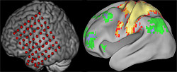 Scientists used direct monitoring of the brain via a temporary implanted grid of electrodes (left) and functional magnetic resonance imaging (right) to detect a low-frequency brain signal that doesn't stop, even in sleep, and may help enable many cognitive functions.