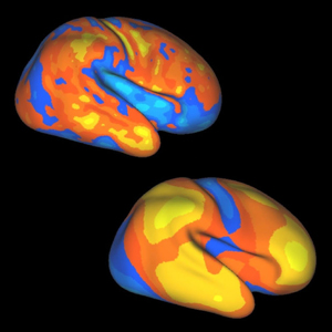 Brain expansion