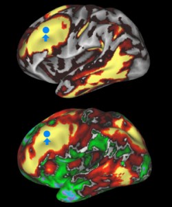 Brain scans
