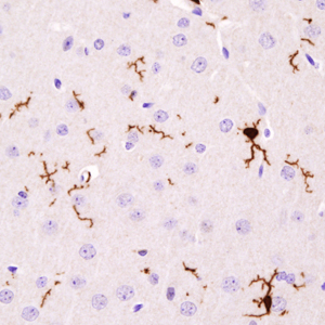 MIcroglia