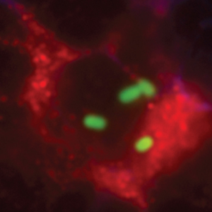 Listeria in the spleen