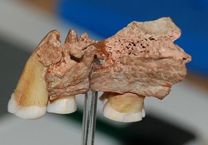 Kent's Cavern jawbone