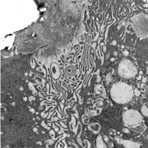 Osteoclast meets bone