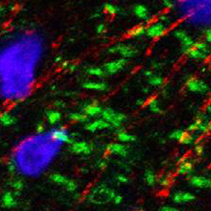Retinal ganglion micrograph
