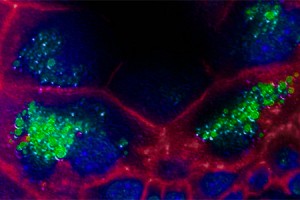 Infection-causing bacteria