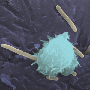Immune cell attacks urinary tract infection