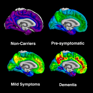 Brain scans