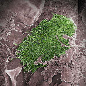 Infection-causing bacteria