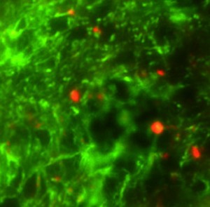 Mouse brain