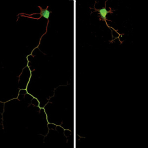Brain cells