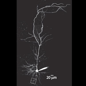 Neuron