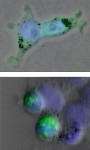 Mutated protein causes clumps in cells