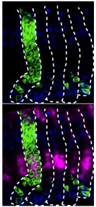 Stomach stem cells