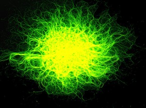 Nerve cells with branches