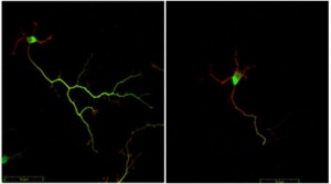 Brain cell comparison