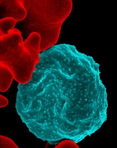 Malaria infection