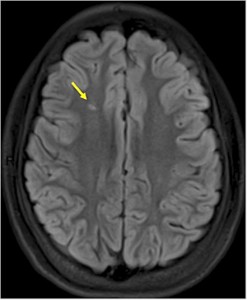 Brain scan