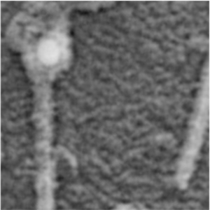 Bacterial anchor