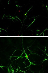 Nerve cells