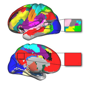 Brain network maps