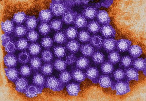 Virus