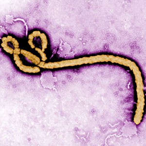 Ebola image