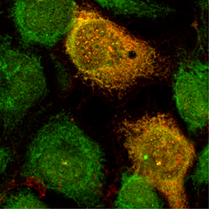 Infected with encephalomyocarditis virus, human cells dial up immune defenses, especially the interferon system. Many of this system’s components, including some newly discovered by researchers at Washington University School of Medicine in St. Louis, converge in cells that harbor the virus and work to interfere with viral replication.