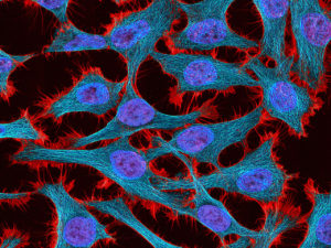 HeLa cells in culture