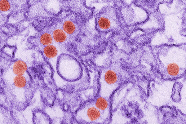 New mouse model to aid testing of Zika vaccine, therapeutics