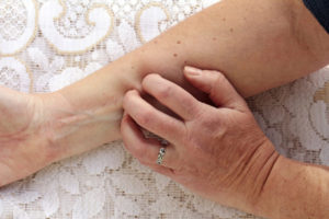 A hand scratching a wrist.