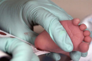 The foot of a newborn baby undergoing a test.