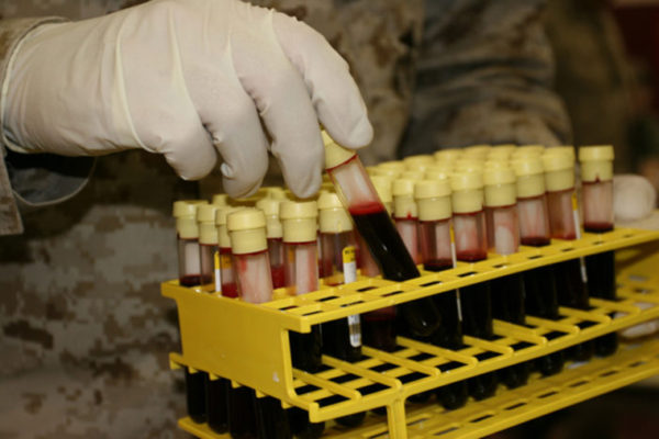 Why ‘O’ blood types may be more likely to die of cholera