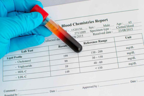 High and low levels of ‘good cholesterol’ may cause premature death