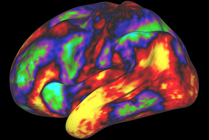 multicolored brain image